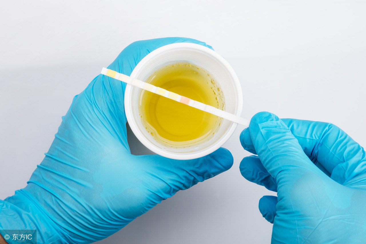 高尿酸血症吃什么药副作用最小,高尿酸的预防食谱