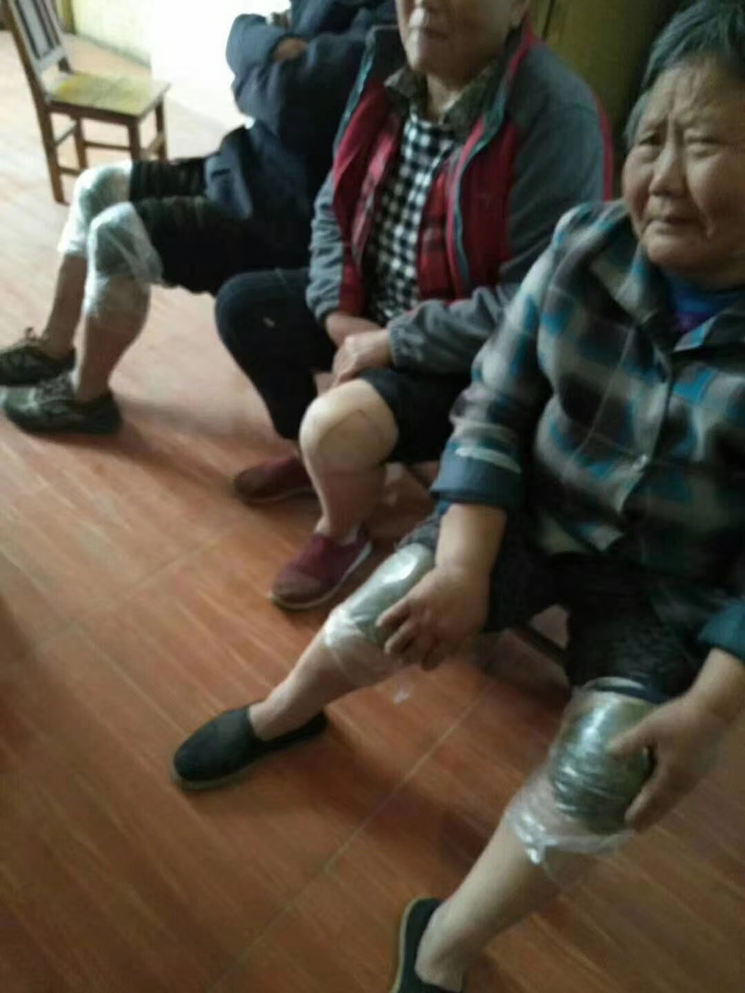 骨性关节炎用什么膏药有效,骨性关节炎治疗有效方法