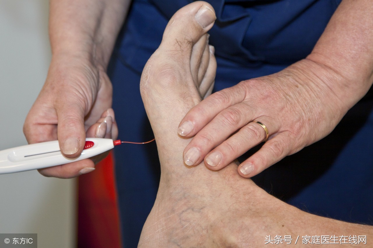 如果不想得糖尿病不能吃哪些食物,不想得糖尿病需要注意哪些事项