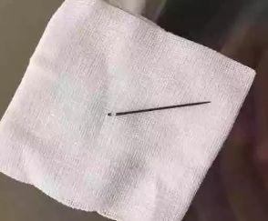 万万没想到！男孩*体下**竟被它紧紧夹住，用手怎么取都取不下！而这回不是拉链裤！