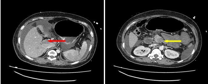 你有一线生机，我必万分努力｜规培医师ICU轮转纪实