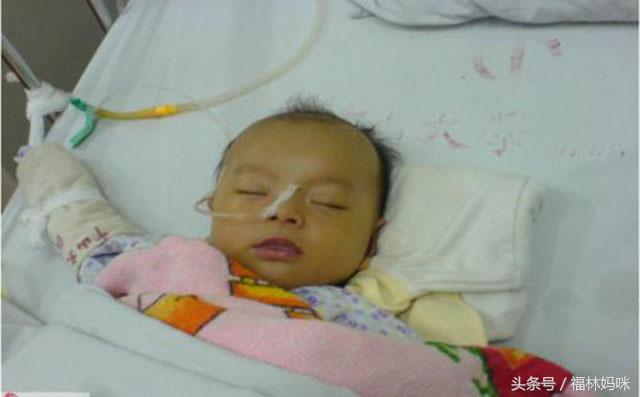 宝宝有黄疸怎么办用什么方法,宝宝黄疸怎么办方法竟然如此简单