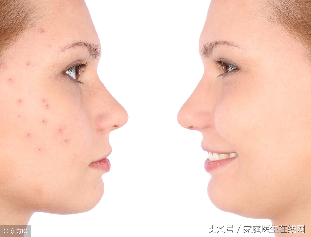 人脸上长痘痘是为什么怎么治,一般人脸上长痘痘是什么原因