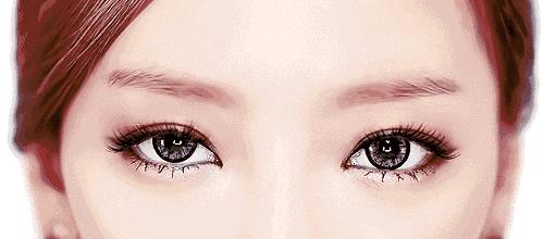 双眼皮埋线的亲身经历,对要做双眼皮埋线的几个建议