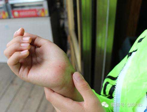 玻璃钢毛刺扎手怎么处理,玻璃丝扎手怎么解决