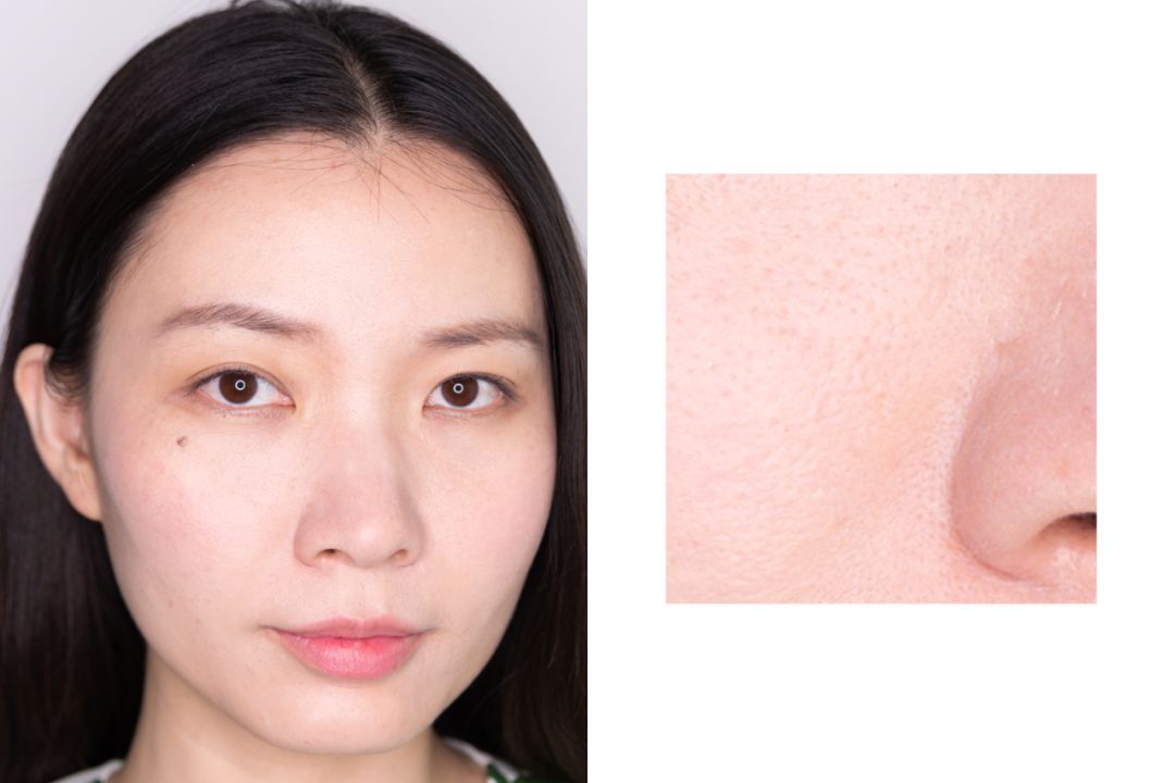 28天解决了所有皮肤问题，你猜我做了些什么？