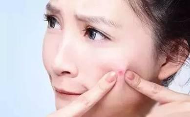 痤疮洗一下脸就起皮怎么回事,邯郸市丛台区中医院皮肤科