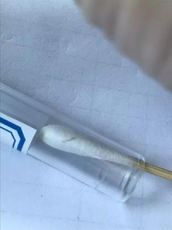 6岁男孩屁臭,6岁男孩屁多怎么回事