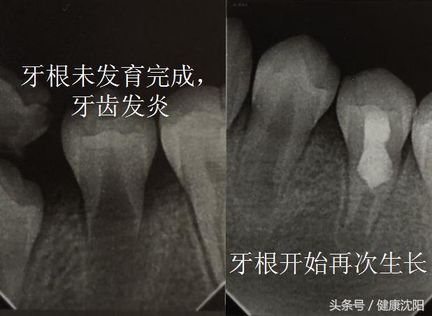 健康科普牙科,健康科普口腔科普