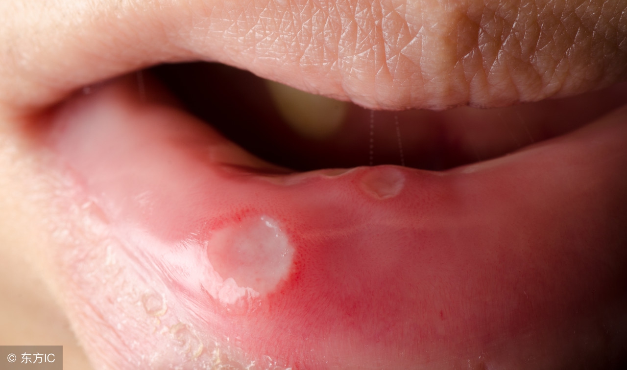 孕妇闻了十几分钟风油精会怎样,孕妇鼻塞不通气可以用风油精吗