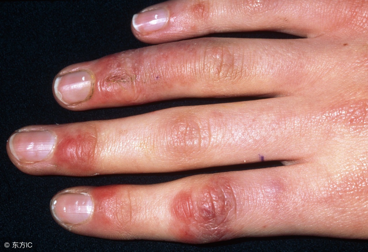 孕妇闻了十几分钟风油精会怎样,孕妇鼻塞不通气可以用风油精吗