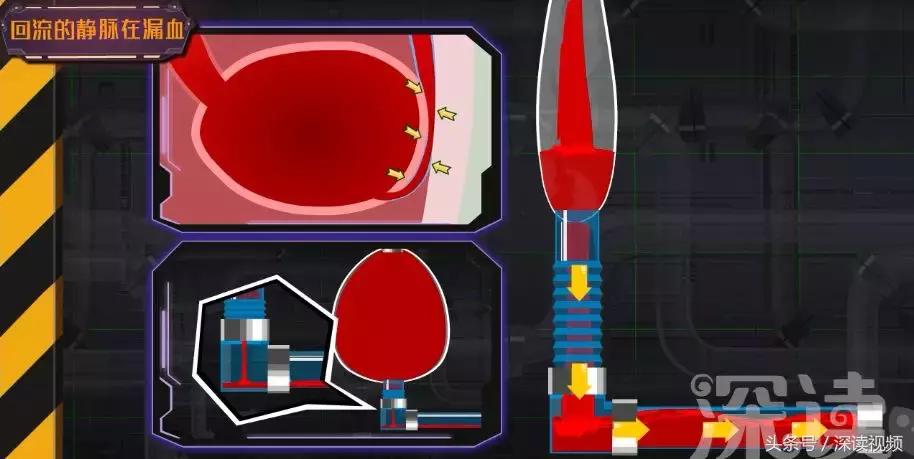 谁让你“兄弟”不给力,谁让你“痿”靡不振?阳痿真凶都在这啦!