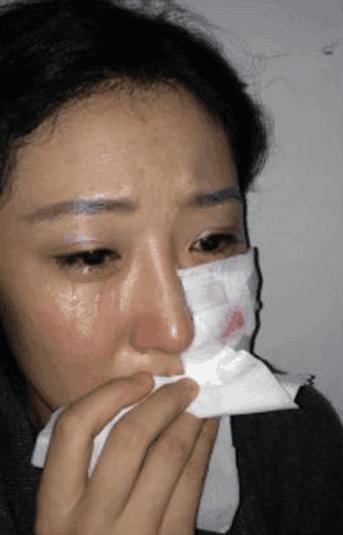 盘点明星拍戏时突发意外,盘点明星发生的意外事件