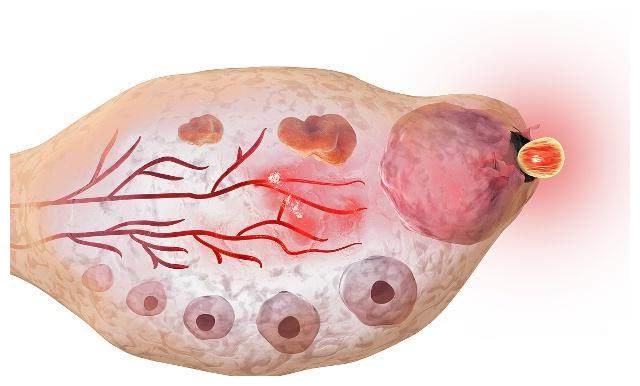 排卵当日有什么症状或感觉,正在排卵时一般女性有什么症状