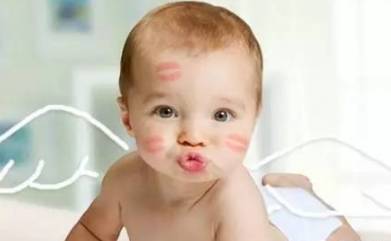 亲吻病怎么感染的,亲吻病的最佳治疗方法