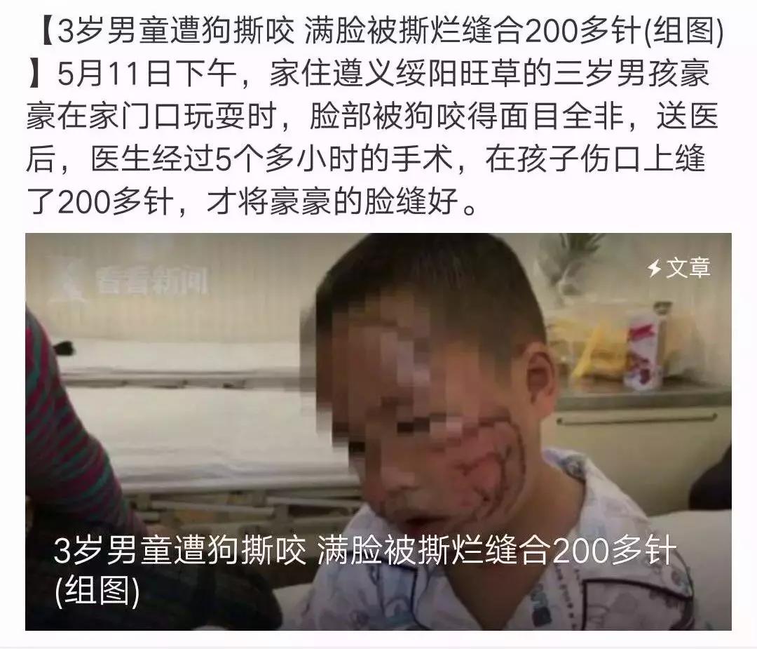 被狗紧咬怎么办,被狗咬住怎样才能挣脱