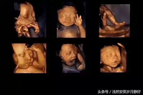 临沂和美家四维彩超是199吗,临沂和美家四维彩超的价格