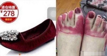 1400元凉鞋掉色脚上染出鞋这些人的脚丫比她还惨