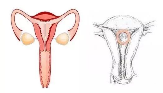 老公愿意去结扎说明什么,想做结扎的手术
