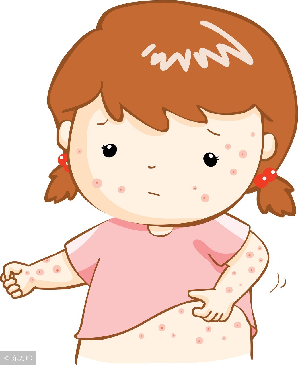 湿疹皮炎反复复发怎么治,名医讲堂湿疹反复复发怎么办