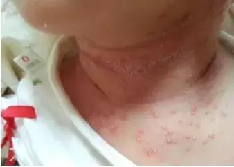 娃儿身上长“可可”该挂哪个科,妈老汉儿遇到这种情况最容易打蒙!