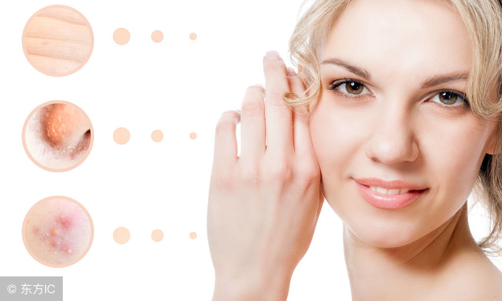 祛痘印痘坑痘疤真实有效,痘印痘疤痘坑可以彻底修复好吗