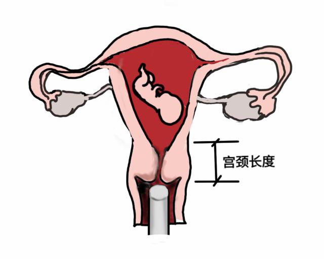 孕妈们为啥要做四维彩超,孕妇为什么要做泌尿系统彩超检查