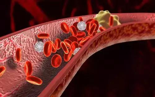 她按个摩“花”了十几万，差点偏瘫！这2个部位很脆弱，别乱按