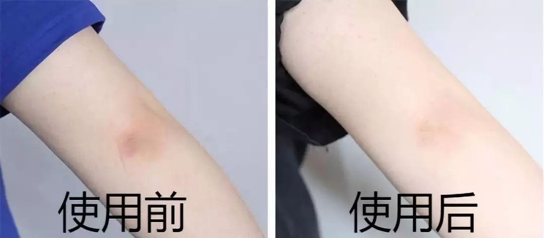 女生最需要保养的部位,适合女性的保养部位