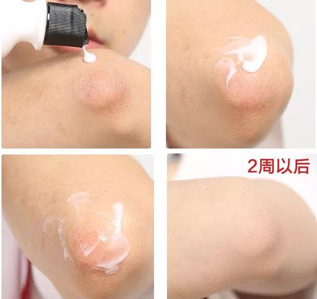 女生最需要保养的部位,适合女性的保养部位