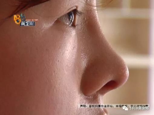 老总嫌她鼻子不好看，说贴钱让她去整下……后面的问号越来越多