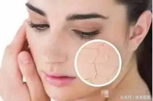 敷面膜脸痛是怎么回事,为什么敷了面膜会感觉脸上好难受