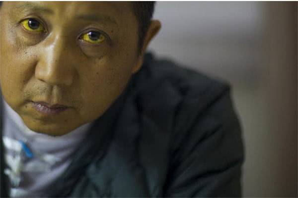 乔布斯癌症早期症状,乔布斯癌症是早期发现的吗