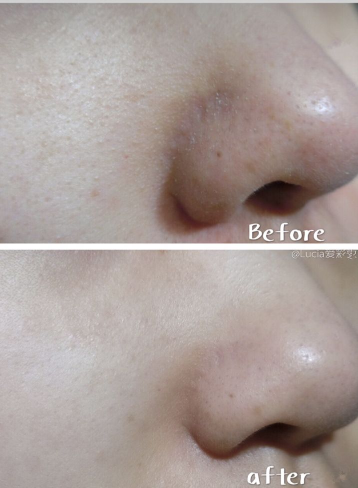 luna洁面仪日版和韩版哪个好,亲测好用四款洁面