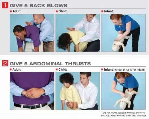 吃东西被噎住的方法叫什么名字,吃东西被噎住自救方法搞笑