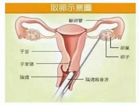 18岁嫩模1700万拍卖*夜初**：不要在最好的年纪，做最糟蹋自己的事！