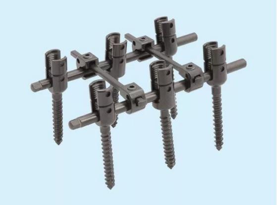 脊柱打6个钢钉手术需要多长时间,脊椎打钉子取出要做手术吗