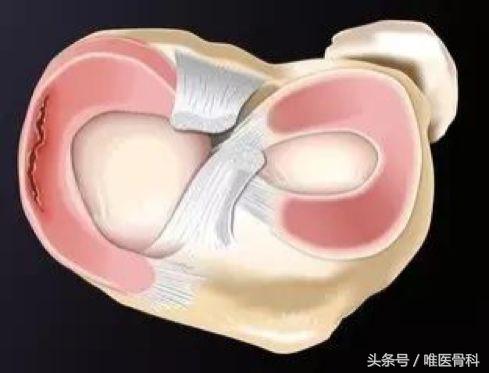 nba半月板损伤都是怎么恢复的,nba球星半月板损伤恢复比较好的