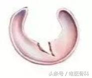 nba半月板损伤都是怎么恢复的,nba球星半月板损伤恢复比较好的