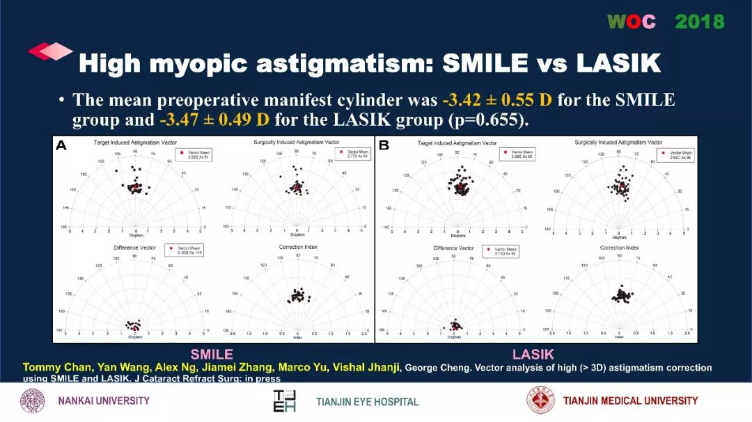 散光治疗技术突破,散光的矫正
