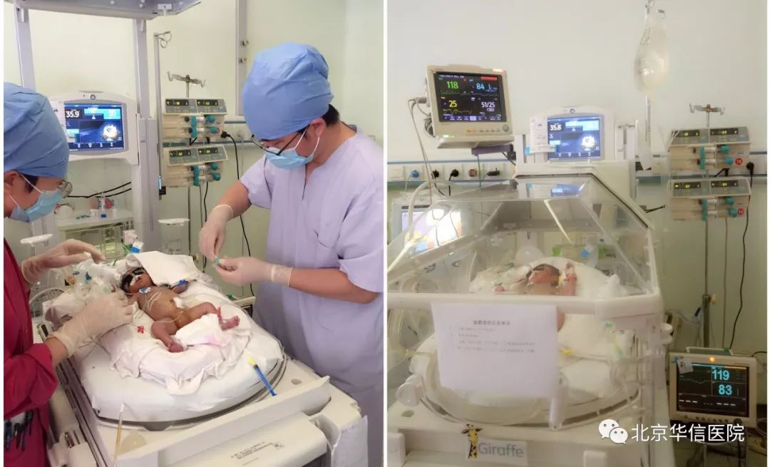 首例29周1640g急性肾功能衰竭早产儿在北京华信医院成功实施腹膜透析治疗