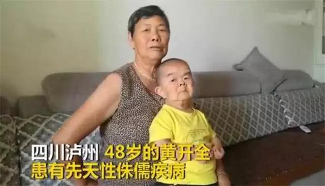 48岁儿子体重24斤，72岁老母亲：不敢死，怕没人照顾他