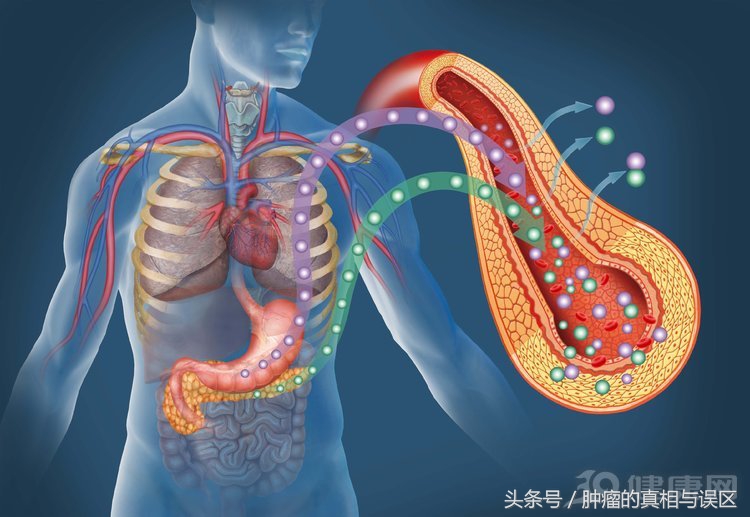 癌中之王胰腺癌,胰腺癌为什么被称为癌症之王