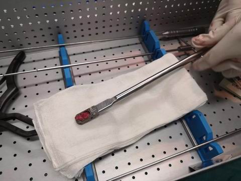 安阳市安钢总医院骨科专家,安钢医院脊柱微创中心主任名单