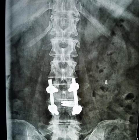 安阳市安钢总医院骨科专家,安钢医院脊柱微创中心主任名单