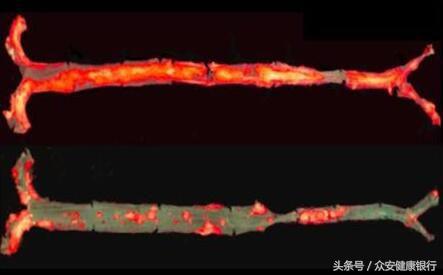 免疫抑制剂治疗hiv,中科众安基因疗法进展