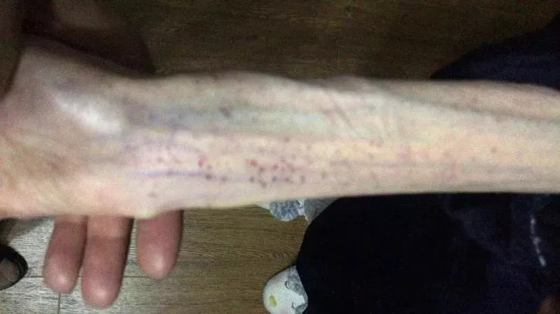 吓人!1米67只有50斤!21岁女孩“自杀式减肥”,照片不忍直视