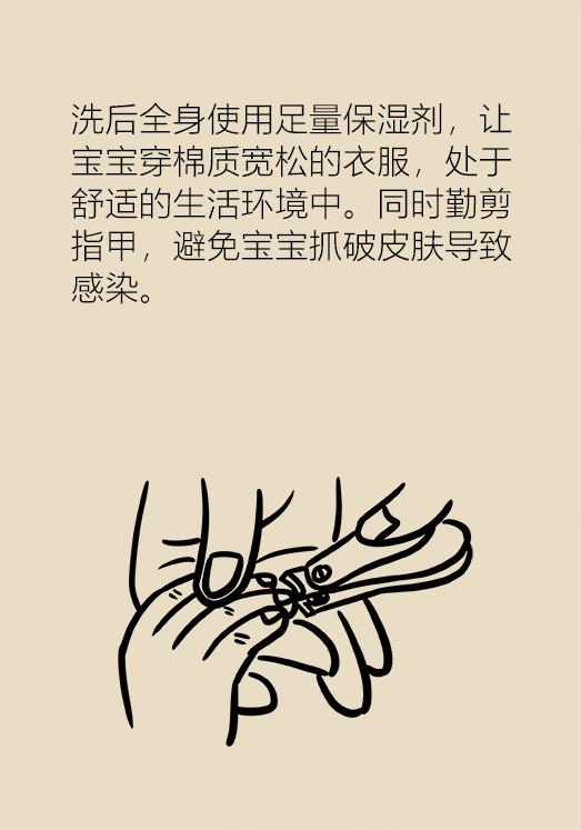 湿疹反复去医院挂哪个科,湿疹看西医反反复复怎么办