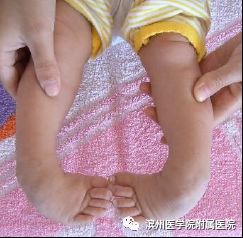 先天性马蹄内翻足能治好吗,先天性马蹄内翻足矫正视频