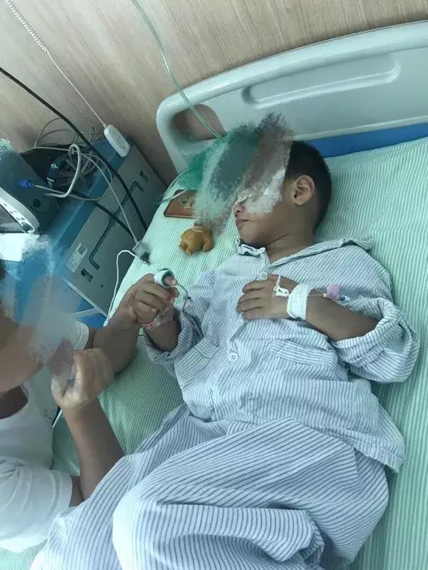 小孩不小心摔跤眼睛受损,四岁孩子摔破眼睛边